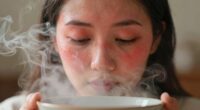 facial steaming worsens redness