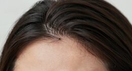 hair cycle delays growth