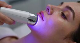 led s hyperpigmentation effects