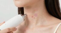 preventing pore bruising