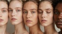 understanding fitzpatrick skin types