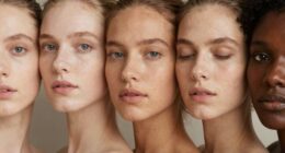 understanding fitzpatrick skin types