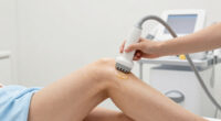 12 Best RF Devices for Cellulite in 2026