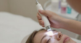 13 Best Best Microneedling Pen With LED in 2026