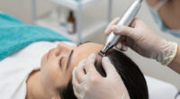 13 Best Microneedling Pen for Scalp in 2026