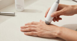 14 Best RF Device for Hands and Crepey Skin in 2026
