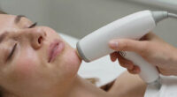 8 Best IPL Devices for Upper Lip in 2026