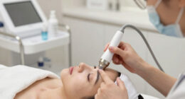 8 Best RF Devices for Under Eye Tightening in 2026