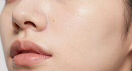 cryo tools reduce pore appearance