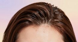 healthy scalp luxury hair