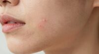 home devices improve skin appearance