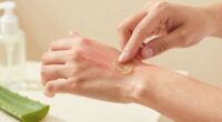 protect skin post treatment