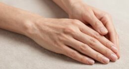 rf devices improve skin appearance