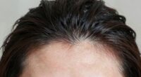 scalp and skin connection